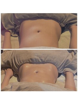 ヴァローレ(valore)/骨盤から整える腸もみ