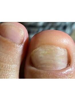 爪の悩みを解消できる（ケア含む）