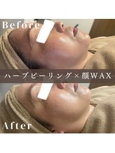 エピナ 秋田店(Epina)/フェイシャルWAX＋ハーブ★