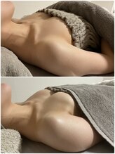 美 プラス(美 Plus)/【産後バストのお悩み】