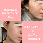 メナードフェイシャルサロン 光の森