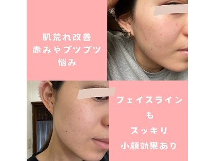 メナードフェイシャルサロン 光の森の写真