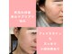 メナードフェイシャルサロン 光の森の写真