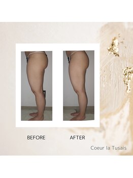 クーラ テュセ(Coeur la Tusais)/下半身集中痩身
