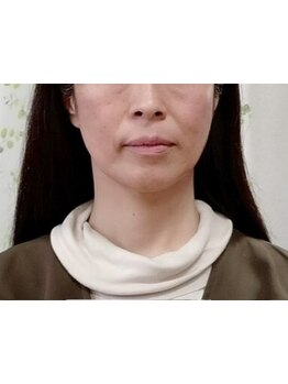 お肌をきれいにしたい