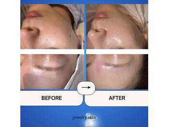 ジュエリースキン(JewelrySkin)/この1回で変わる毛穴と潤い実感