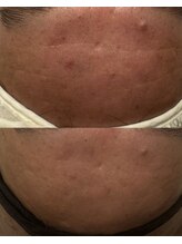 ルルアス(LuLu AS)/