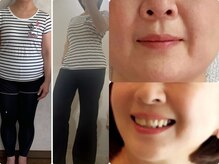 リミューズ マロアマーノ(Re.MUSE MAROaMano)