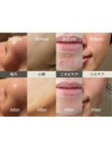 ルディラ 恵比寿店/ルディラ医療提携エステ