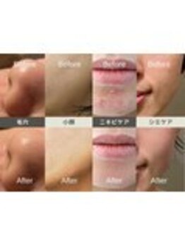 ルディラ 恵比寿店/ルディラ医療提携エステ