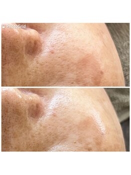 private salon Ponola【ポノーラ】/バンテージ