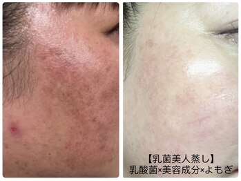 リセラージュ(Recellage)/【よもぎ蒸し】乳菌美人蒸し