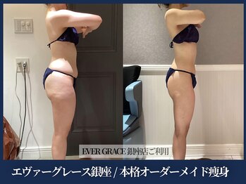 エヴァーグレース 宇都宮店/ 燃焼系BODY作りサポートします