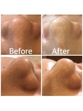 フォーケア(4Care)/ハイドロスキン