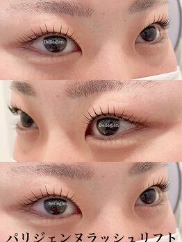 ベルグレン(Belleglen)/