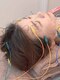 フィジオ(physio)の写真/【美容鍼】継続することで肌質が変わり、くすみが取れてメイクノリも飛躍的にアップ★エイジングケア！