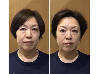 北海道スポーツ整体院/美容鍼灸