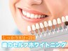 【歯セルフホワイトニング】ツルピカ★白さを実感〈8分×2回〉¥2900