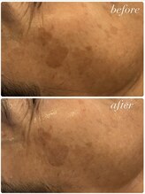 ビンナ 五反田店(Binna)/ハーブの力で