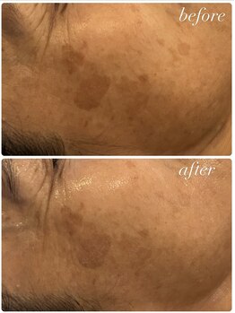 ビンナ 五反田店(Binna)/ハーブの力で