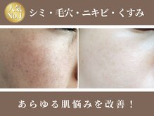 キレイ(KIREI)