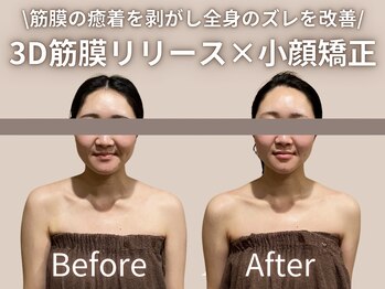 リル 和歌山市店(lilou)/3D筋膜リリース小顔矯正