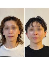 アガルコガオサロン(AGARU KOGAO SALON)/