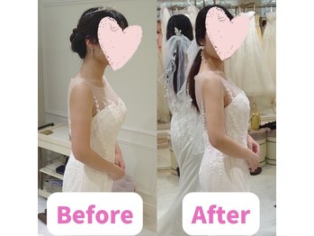ボディキュア ブライダル美容整体 大阪梅田/写真うつりが気になる方へ/関西