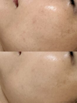 フェリノ(FERINO)/さすがエンビロン!!!