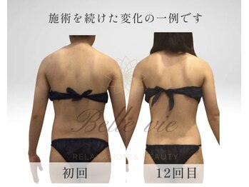 ベルヴィー/天使の羽作りが得意です