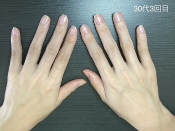 桃の木 吉祥寺店/30代お客様