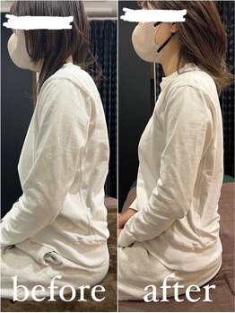 スパチャーレ(Spa ciare)/【骨盤矯正&猫背矯正】