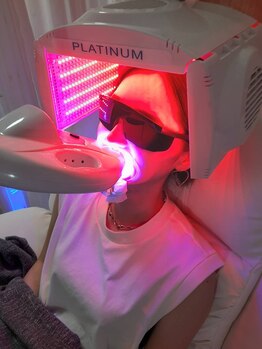 ライトビューティー 本八幡店(LIGHT BEAUTY)/スカルプ・セルフホワイトニング