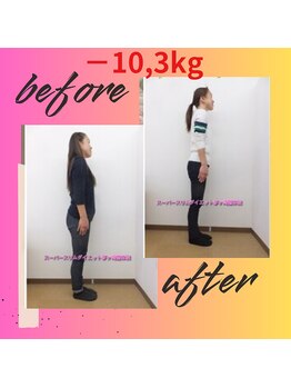 スーパースリムダイエット茅ヶ崎 茅ヶ崎整体院/3ヵ月－10,3ｋｇダイエット♪