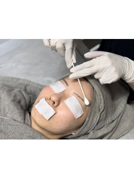 シミしわ改善！予防ケア