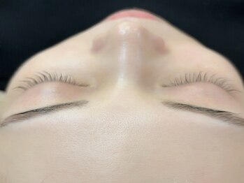 アネラ キキ サロン(anela kiki salon)の写真/【大人気！韓国女優肌ピーリング☆¥11000】変化を感じて自信に繋がる◎紫外線で酸化した肌のメンテナンスに