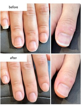 ケアプラス(care plus)/ハンドネイルケア