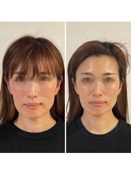 アガルコガオサロン(AGARU KOGAO SALON)/