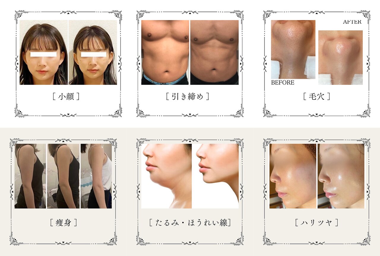 メディカルエステ 新宿南口店｜ホットペッパービューティー