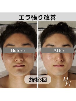 ミピマム/メンズのお客様も大歓迎