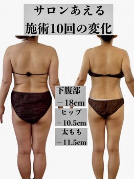 サロンあえる 新大宮店/痩身エステ/ダイエット