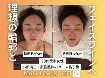 ルルラボ(LuLu beauty labo)/憧れの輪郭と美ライン