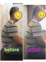 くすの樹接骨院 整体院 鳥栖院/整体/骨盤矯正ビフォーアフター