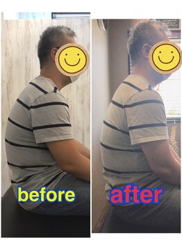 くすの樹接骨院 整体院 鳥栖院/整体/骨盤矯正ビフォーアフター