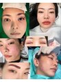 リメイククリニカルビューティー(Remake clinical beauty)&nbsp;休みの日は、美容経験値を増やしにいろいろ受けに行ってみたり