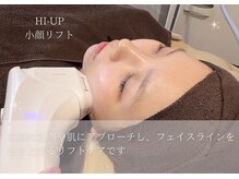 ベル 大和(Belle)/HI-UP|小顔