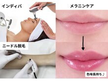 リザルト(Re'ZAlt)