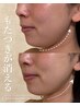 ＼5月限定キャンペーン／究極たるみケアコース（下顔面ケア）