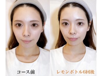 イーズ ららぽーと湘南平塚店(E/S)/
