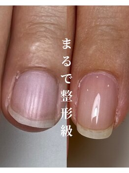 ロイヤル ビューティー サロン(Royal Beauty Saloon)の写真/お爪を根本から改善し美爪へ導きます/自爪育成/深爪育成